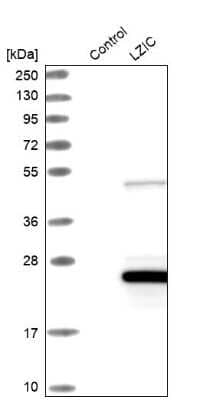 Western Blot: LZIC Antibody [NBP1-81197]