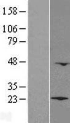 Western Blot: LZIC Overexpression Lysate [NBL1-12775]