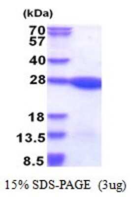 SDS-PAGE: Recombinant Human LZIC His Protein [NBP2-51522]