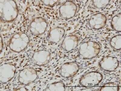 Immunohistochemistry-Paraffin: LZTFL1 Antibody (7F6) [H00054585-M01]