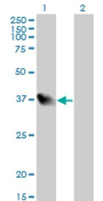 Western Blot: LZTFL1 Antibody (7F6) [H00054585-M01]