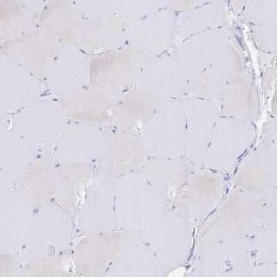 Immunohistochemistry-Paraffin: LZTFL1 Antibody [NBP2-30690]