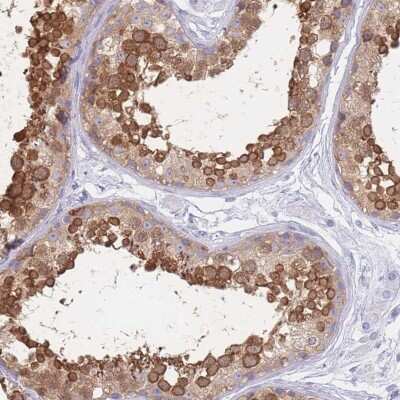 Immunohistochemistry-Paraffin: LZTFL1 Antibody [NBP2-30690]