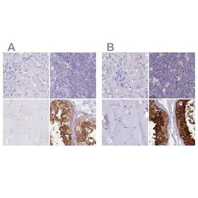 Immunohistochemistry-Paraffin: LZTFL1 Antibody [NBP2-30690]