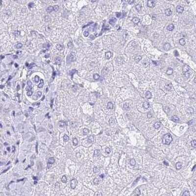 Immunohistochemistry-Paraffin: LZTFL1 Antibody [NBP2-30690]