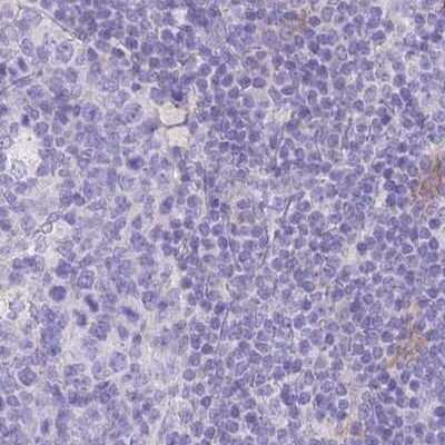 Immunohistochemistry-Paraffin: LZTFL1 Antibody [NBP2-30690]