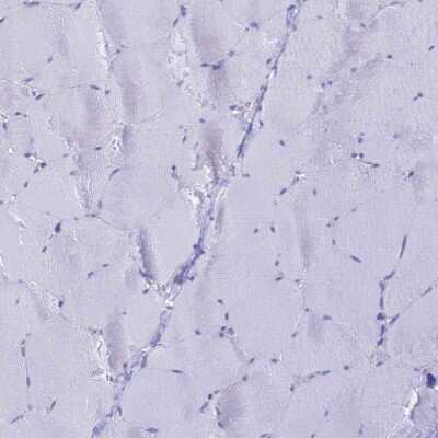 Immunohistochemistry-Paraffin: LZTFL1 Antibody [NBP2-47387]