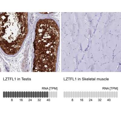 Immunohistochemistry-Paraffin: LZTFL1 Antibody [NBP2-47387]