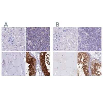 Immunohistochemistry-Paraffin: LZTFL1 Antibody [NBP2-47387]