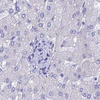Immunohistochemistry-Paraffin: LZTFL1 Antibody [NBP2-47387]