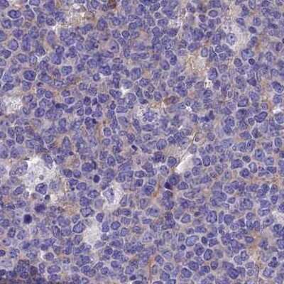 Immunohistochemistry-Paraffin: LZTFL1 Antibody [NBP2-47387]