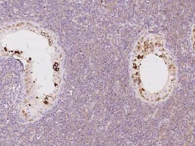 Immunohistochemistry-Paraffin: LZTFL1 Antibody [NBP2-97499]