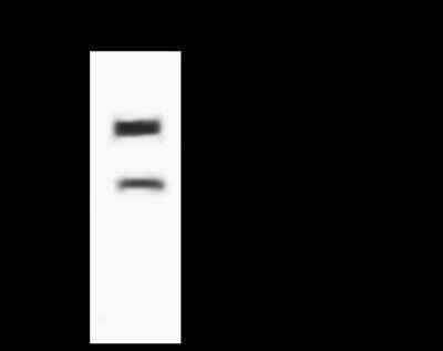 Immunoprecipitation: LZTFL1 Antibody [NBP2-97499]