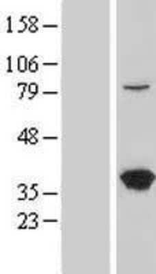 Western Blot: LZTFL1 Overexpression Lysate [NBL1-12776]