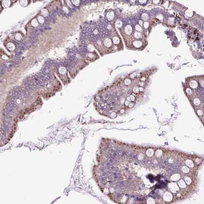 Immunohistochemistry: LZTR1 Antibody [NBP2-49567]