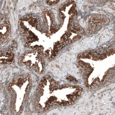Immunohistochemistry-Paraffin: LZTR1 Antibody [NBP2-49649]