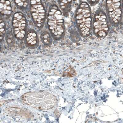 Immunohistochemistry-Paraffin: LZTR1 Antibody [NBP2-49649]