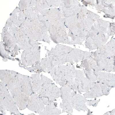 Immunohistochemistry-Paraffin: LZTR1 Antibody [NBP2-49649]