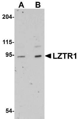 Western Blot: LZTR1 AntibodyBSA Free [NBP1-77121]