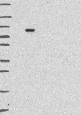 Western Blot: LZTR1 Antibody [NBP3-17734]