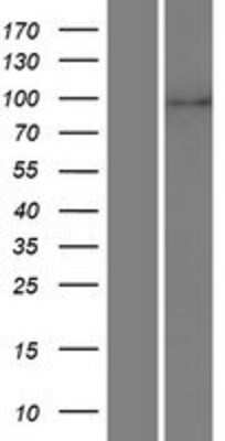 Western Blot: LZTR1 Overexpression Lysate [NBP2-07586]