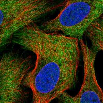 Immunocytochemistry/ Immunofluorescence: LZTR2 Antibody [NBP2-55068]