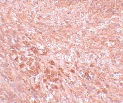 Immunohistochemistry-Paraffin: LZTR2 Antibody - BSA Free [NBP1-77122]