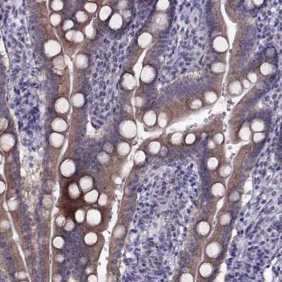 Immunohistochemistry-Paraffin: LZTR2 Antibody [NBP2-62678]