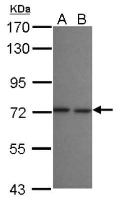 Western Blot: LZTR2 Antibody [NBP2-17194]