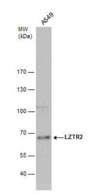 Western Blot: LZTR2 Antibody [NBP2-17194]