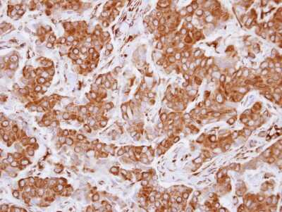 Immunohistochemistry-Paraffin: LZTS1 Antibody [NBP2-17195]