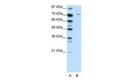 Western Blot: LZTS1 Antibody [NBP2-87762]