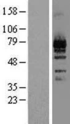 Western Blot: LZTS1 Overexpression Lysate [NBL1-12778]