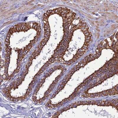 Immunohistochemistry-Paraffin: LZTS2 Antibody [NBP1-82892]