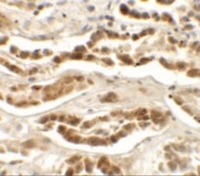 Immunohistochemistry-Paraffin: LZTS2 Antibody - BSA Free [NBP2-41152]