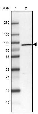 Western Blot: LZTS2 Antibody [NBP1-82892]