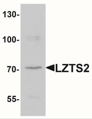 Western Blot: LZTS2 AntibodyBSA Free [NBP2-41152]