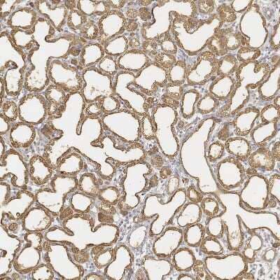 Immunohistochemistry-Paraffin: Lactalbumin Alpha Antibody [NBP1-87715]