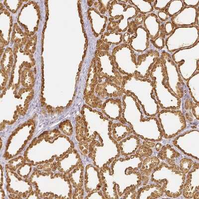 Immunohistochemistry-Paraffin: Lactalbumin Alpha Antibody [NBP2-56836]