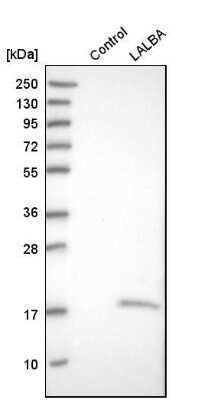 Western Blot: Lactalbumin Alpha Antibody [NBP1-87715]