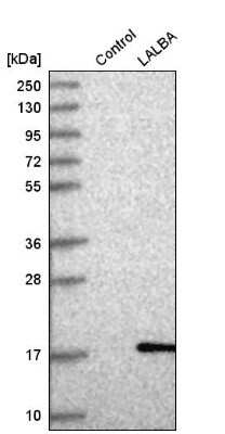 Western Blot: Lactalbumin Alpha Antibody [NBP2-56836]