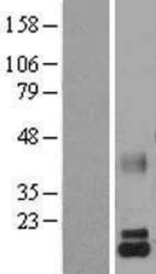 Western Blot: Lactalbumin Alpha Overexpression Lysate [NBL1-12427]