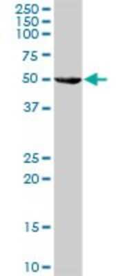 Western Blot: Lactase-like Protein/LCTL Antibody [H00197021-B01P]