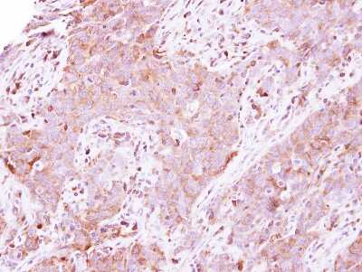 Immunohistochemistry-Paraffin: Lactate Dehydrogenase A/LDHA Antibody [NBP2-19320]