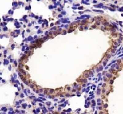Immunohistochemistry: Lactate Dehydrogenase A/LDHA Antibody - BSA Free [NBP1-48336]