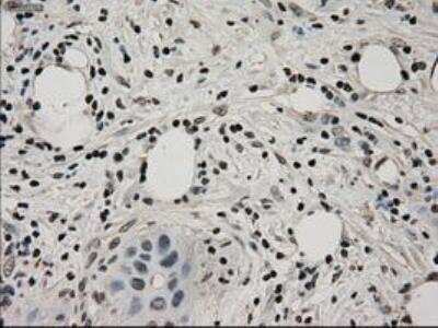 Immunohistochemistry-Paraffin: Lactate Dehydrogenase A/LDHA Antibody (OTI2D11) [NBP1-47822]