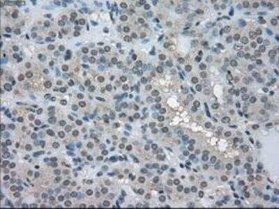 Immunohistochemistry-Paraffin: Lactate Dehydrogenase A/LDHA Antibody (OTI2D11) [NBP1-47822]