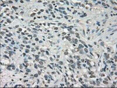 Immunohistochemistry-Paraffin: Lactate Dehydrogenase A/LDHA Antibody (OTI2D11) [NBP1-47822]