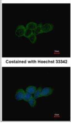 Immunocytochemistry/ Immunofluorescence: Lactate Dehydrogenase A/LDHA Antibody [NBP2-19320]