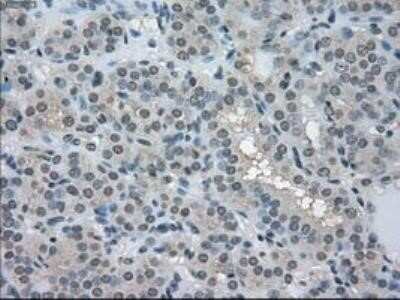 Immunohistochemistry: Lactate Dehydrogenase A/LDHA Antibody (OTI2D11) - Azide and BSA Free [NBP2-71121]
